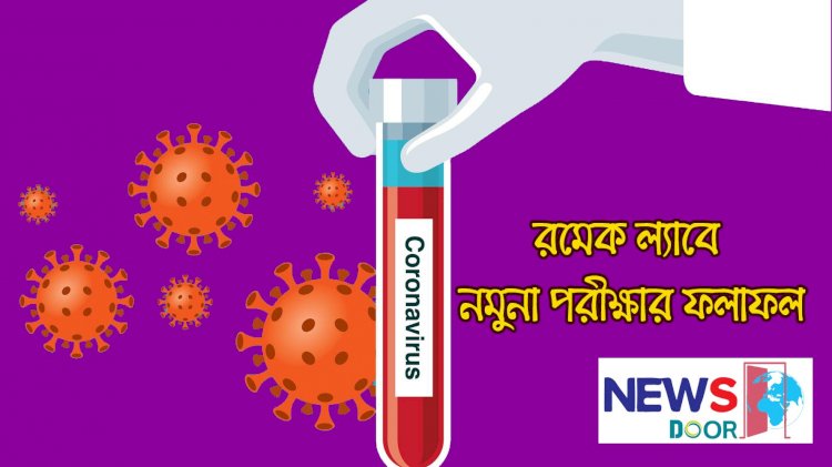 রমেকে নমুনা পরীক্ষায় আরও ৪১ আক্রান্ত ব্যক্তি শনাক্ত