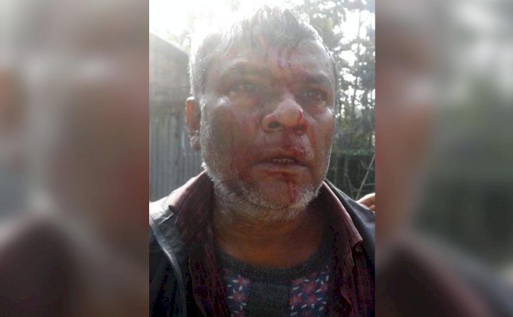 কুড়িগ্রামে দূর্বৃত্তের রডের আঘাতে সাংবাদিক রক্তাক্ত