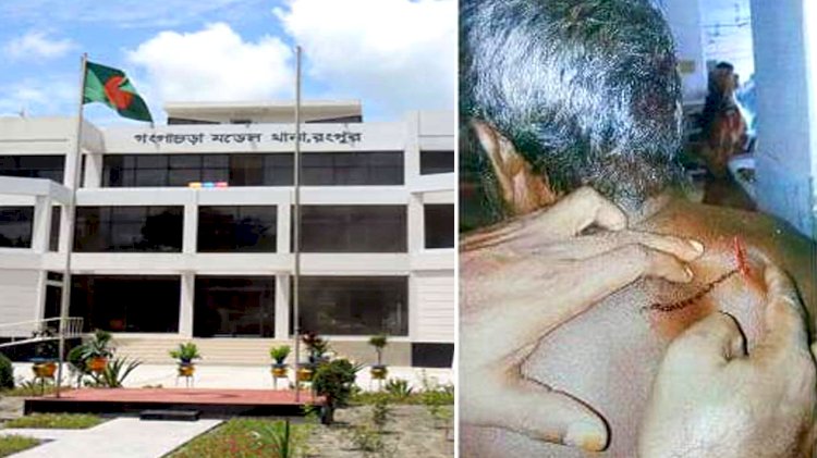 গঙ্গাচড়ায় জমিজমার দ্বন্দ্বে ভাইয়ের হাতে জখম ভাই