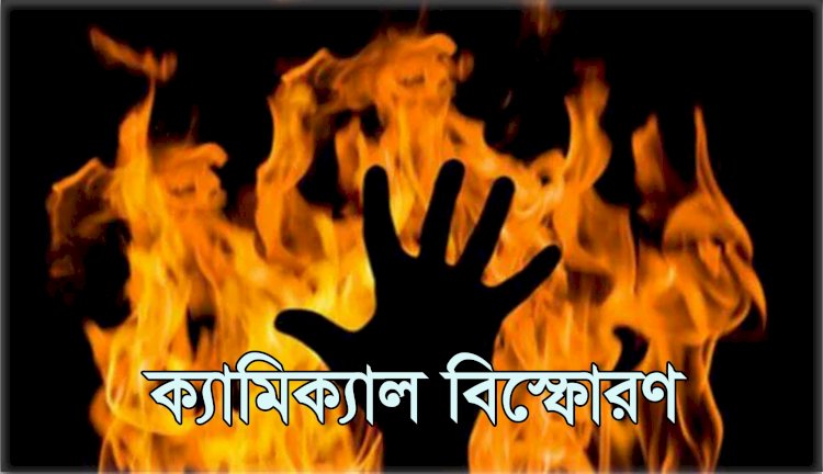 রংপুরে কেমিক্যালের বয়াম বিস্ফোরিত হয়ে দুই শিশু দগ্ধ